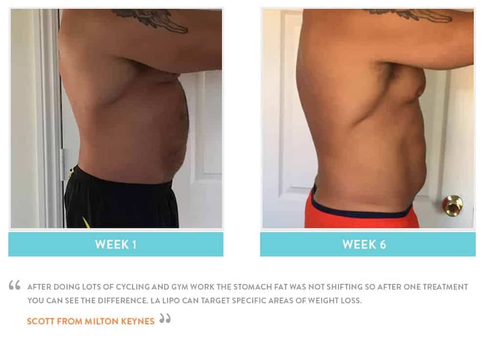 Before & After Stomach Fat Barnes