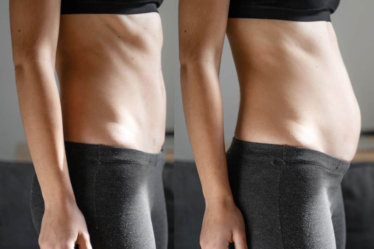 How long does diastasis recti take to improve Barnes?