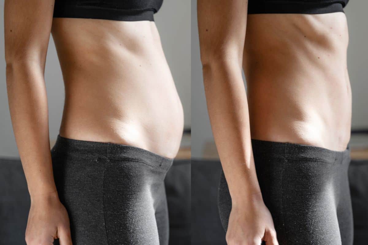 Post-Pregnancy: What Happens to Your Abdominal Muscles After Birth Barnes