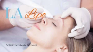 Woman receiving Actinic Keratosis Removal Treatment Barnes
