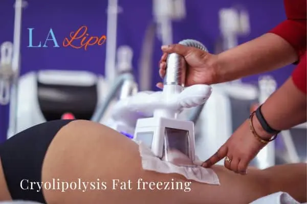 women getting fat freezing Barnes