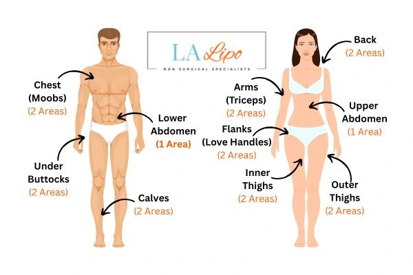 LA LIPO Cryolipolysis Areas Barnes
