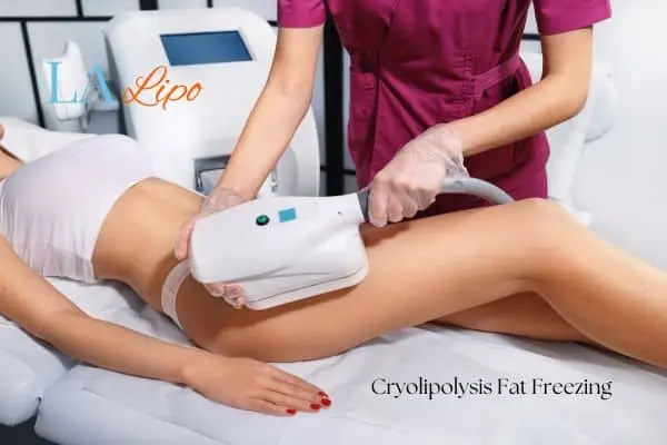 Woman receiving coolsculpting Barnes treatment on her thighs