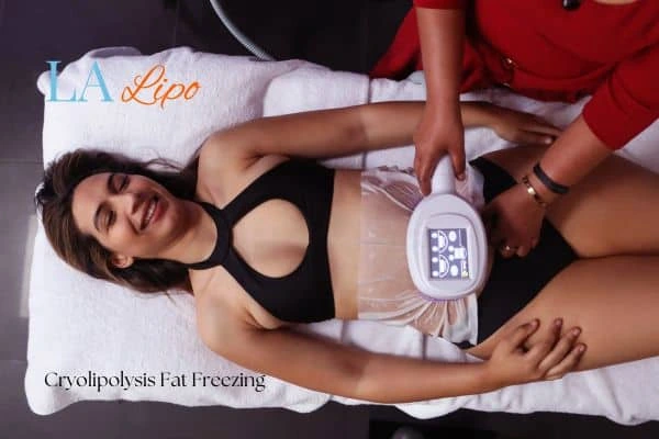 woman getting cryolipolysis Barnes