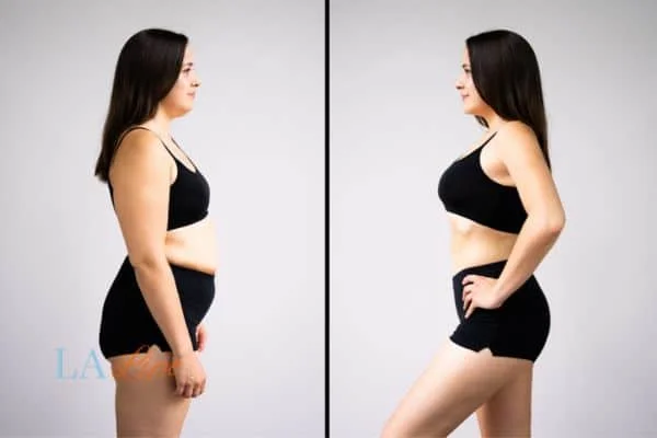 link between body image and mental health Barnes