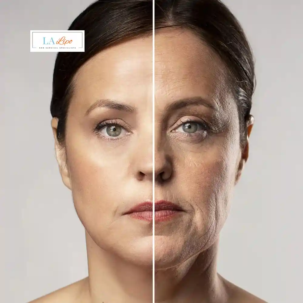 How Can You Tell If Non-Surgical Skin Tightening Is Right for You Barnes?